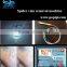 980 nm diode laser /vascular therapy 980 laser vascular therapy Blood Vessels Remova 980 nm /980nm China POPIPL