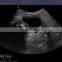 3D reconstruction 15 inch LCD screen portable usb color doppler ultrasound equipment with probe