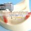 Typodont Orthodontic Model for Practicing teeth model factory