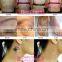 New Portable 1064nm & 532nm Q Switch ND Yag Laser Tattoo Removal Machine