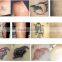 532nm Hot Sale Q Switched Nd Yag Laser Pigmented Lesions Treatment Tattoo Removal Nd Yag Laser Tattoo Removal Machine