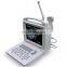 PL-3018VP Veterinary Full Digital Portable Ultrasound Scanner