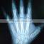 China KND-A/F CE medical dry film agfa healthcare
