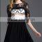 Pretty Steps 2016 elegant ladies casual round collar autumn dress sexy woman lace half sleeve casual dress