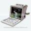 Coupon available! MSLPU01 cheapest portable ultrasound machine on 