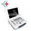 HC-A003 cheap portable ultrasound scanner price with 12 inch HD LCD display