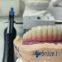 CAM Milled Titanium Bar Dental Implant Hybrid Prosthesis Dentures Metal Implant Bar