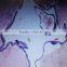 Mixed Medical science study human oral medical diseased slides set