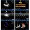 MY-A039B Portable Cardiac Ultrasound System Color Doppler Ultrasound Machine Scanner Price with Ultrasound Probe