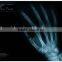 radiographic x ray digital radiography equipment medical x ray equipment digital xray film