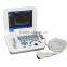Carejoy laptop Ultrasound Scanner with multi frequency probe ultrasonic diagnostic system RUS-9000F2