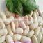 Chinese white kidney beans of good quality