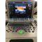 Cheapest price MY-A024B-N Medical Portable Digital 4D Color Doppler Ultrasound Machine with CW function