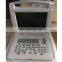 Digital portable ultrasound scanner for sell