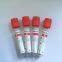 plain blood tube red top blood tube blood test tube