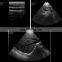 MY-A010B Medical handheld ultrasonic scanner Portable android/ios type Wireless Ultrasound Probe