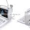 12.1 inch LED Display Portable Ultrasound Scanner Black and White Ultrasound Machine