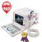 CE approved Laptop/Portable Ultrasound Scanner with 3.5Mhz multi-frequency convex probe RUS-6000D