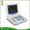 OEM Factory 10.4 Inch TFT Color LCD Laptop Portable Ultrasound Machine for Pregnancy