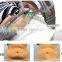 Cool tech fat freezing machine for belly fat removal