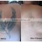 permanent tattoo without needles! 2016 hot sale beauty equipment q switch nd yag laser tattoo removal