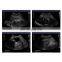 Image review & storage fully digital laptop ultrasound machine color doppler scanner device