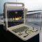 Superior 15 inch full digital color doppler system for hospital use