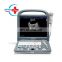 Sonoscape ultrasound Factory price 3D/4D Potable Colorful doppler ultrasound machine Sonoscape S2 for Veterinary