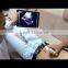 MSLPU31K price laptop scan scanner wireless ultrasound probe