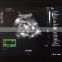 12 inch HD LCD monitor full digital  Portable medical ultrasound instruments color doppler ultrasound