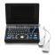 2016 new 3D laptop ultrasound machine low price