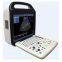 Doppler ultrasound diagnostic system