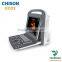 medical User-friendly 2d portable black and white ultrasound CHISON ECO2