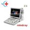 Popular  trolley scanner mindray / z6 mindray /buy ultrasound scanner for hospital