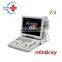 Popular  trolley scanner mindray / z6 mindray /buy ultrasound scanner for hospital