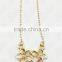 Juyuan Fashion 18K Gold Three Color Crystal,rhinestone Baby Set