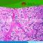 Individual slides you can choose from High Quality Human Pathological Histology Prepared Microscope Slides