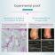 Máquina profissional de terapia de emagrecimento por criolipólise do abd?men com escultura corporal a gelo Trusculpt ID para redu??o de gordura
