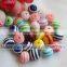 High Quality 8mm Rhinestone Round Stripe Beads Round Plastic Beads to Make Christmas Ornaments