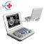 Full digital USB ultrasound Laptop PC system