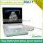 Sonostar hospital veterinary equipment B model ultrasound machine for sale V9