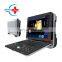 HC-A012F Ultrasound Scanner The Most Economical Portable Color Doppler Ultrasound Scanner color doppler ultrasound machine