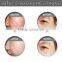Vascular Lesions Removal Hot Home Laser IPL Hair Portable Removal/ IPL Elight RF Skin Rejuvenation Beauty Machine 560-1200nm