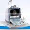 Laptop Doppler Ultrasound Scanner-CE certified medical ultrasound machine