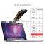 For MacBook Pro 13 Screen Protector, Vikoo 9H Hardness Ultra-thin Shatterproof Anti-Scratch HD Clear Ballistic Tempered Glass