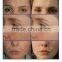 2015 galvanic ultrasonic microcurrent skin care device