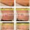 2015 hot sale new shockwave / awt slimming beauty machine - CE