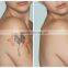 2015 Professional Medical Q-Switch ND Yag Laser Machine Telangiectasis Treatment For Tattoo Removal And Birthmark Removal Vascular Tumours Treatment