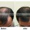 ROYAL-HG211 Machine Height Can Adjustable Laser Hair Growth Equipment