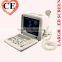 2016 Large Screen LED Clear Image Full Digital Portable ultrasounic Scanner Machine System with 2 probe connector
